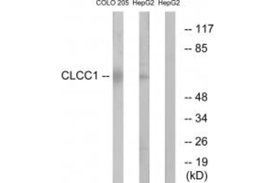 Western blot - CLCC1 Antibody from Signalway Antibody (34578) - Antibodies.com