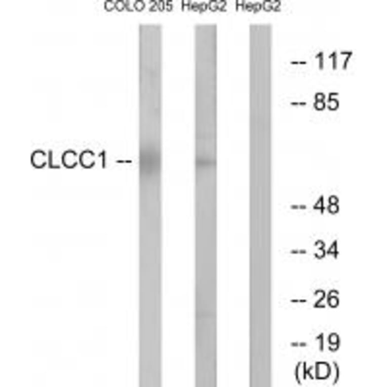 Western blot - CLCC1 Antibody from Signalway Antibody (34578) - Antibodies.com