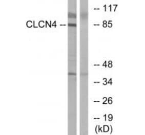 Western blot - CLCN4 Antibody from Signalway Antibody (34579) - Antibodies.com