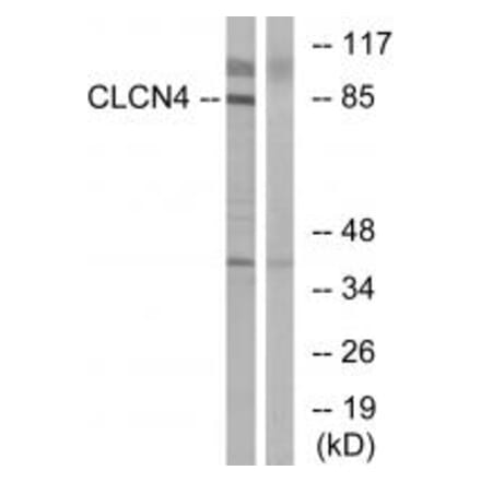 Western blot - CLCN4 Antibody from Signalway Antibody (34579) - Antibodies.com