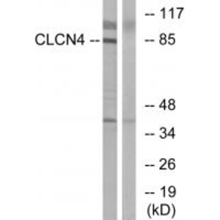 Western blot - CLCN4 Antibody from Signalway Antibody (34579) - Antibodies.com