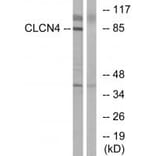 Western blot - CLCN4 Antibody from Signalway Antibody (34579) - Antibodies.com