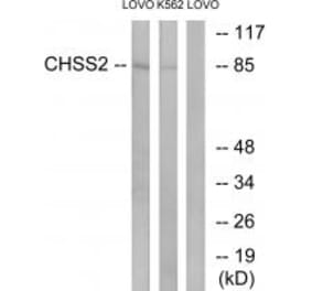 Western blot - CHSS2 Antibody from Signalway Antibody (34589) - Antibodies.com