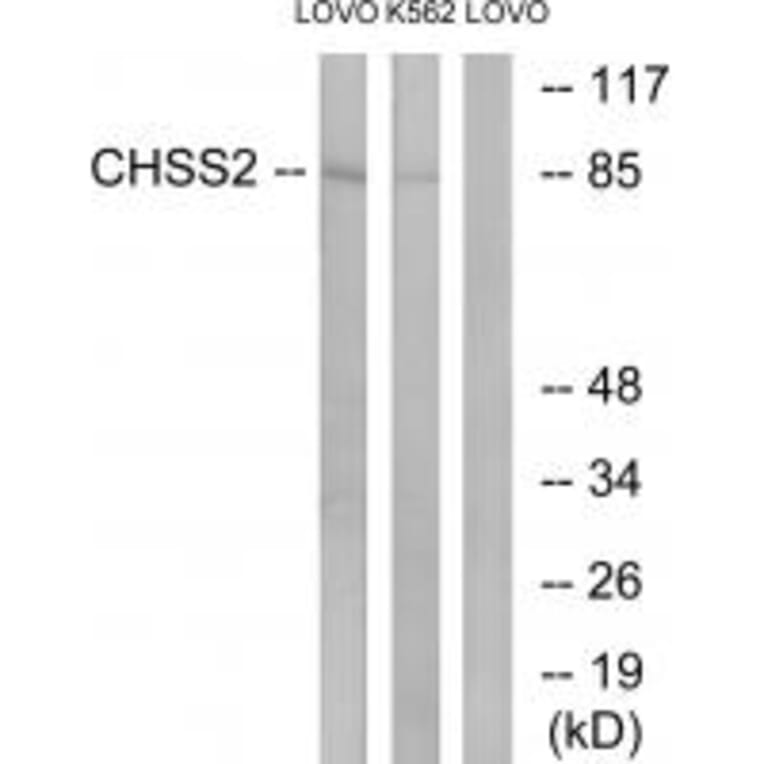 Western blot - CHSS2 Antibody from Signalway Antibody (34589) - Antibodies.com