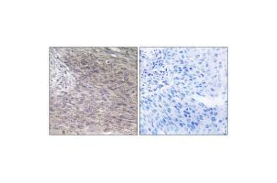 Immunohistochemistry - CHSS2 Antibody from Signalway Antibody (34589) - Antibodies.com