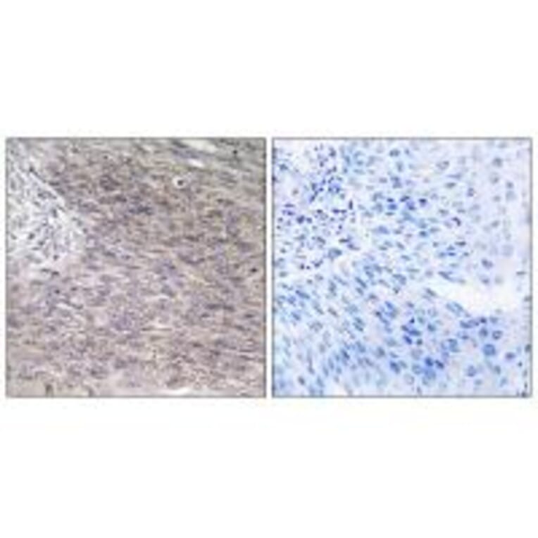 Immunohistochemistry - CHSS2 Antibody from Signalway Antibody (34589) - Antibodies.com