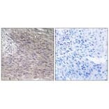 Immunohistochemistry - CHSS2 Antibody from Signalway Antibody (34589) - Antibodies.com