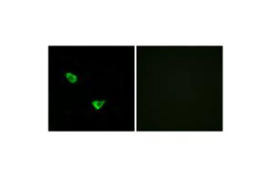 Immunofluorescence - CHSS2 Antibody from Signalway Antibody (34589) - Antibodies.com
