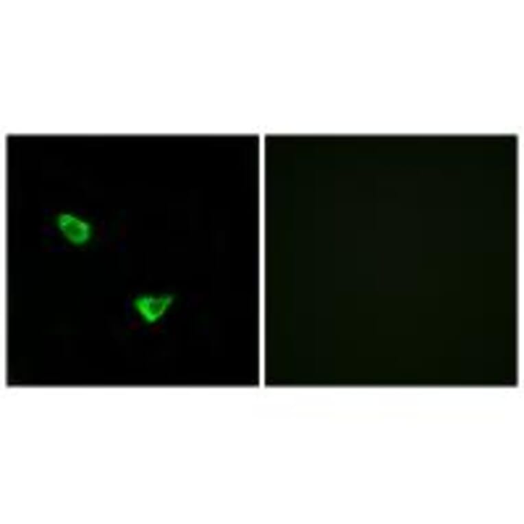 Immunofluorescence - CHSS2 Antibody from Signalway Antibody (34589) - Antibodies.com