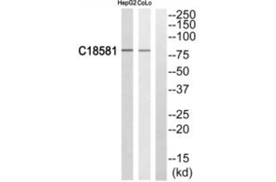 Western blot - NEK5 Antibody from Signalway Antibody (35021) - Antibodies.com