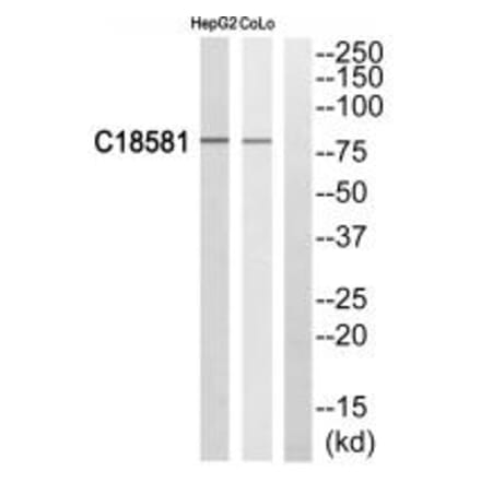 Western blot - NEK5 Antibody from Signalway Antibody (35021) - Antibodies.com