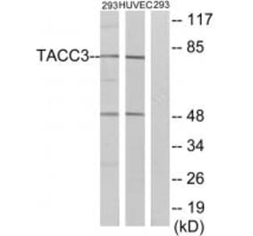 Western blot - TACC3 Antibody from Signalway Antibody (35171) - Antibodies.com