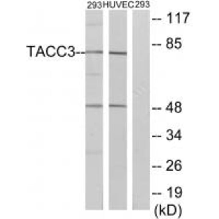 Western blot - TACC3 Antibody from Signalway Antibody (35171) - Antibodies.com