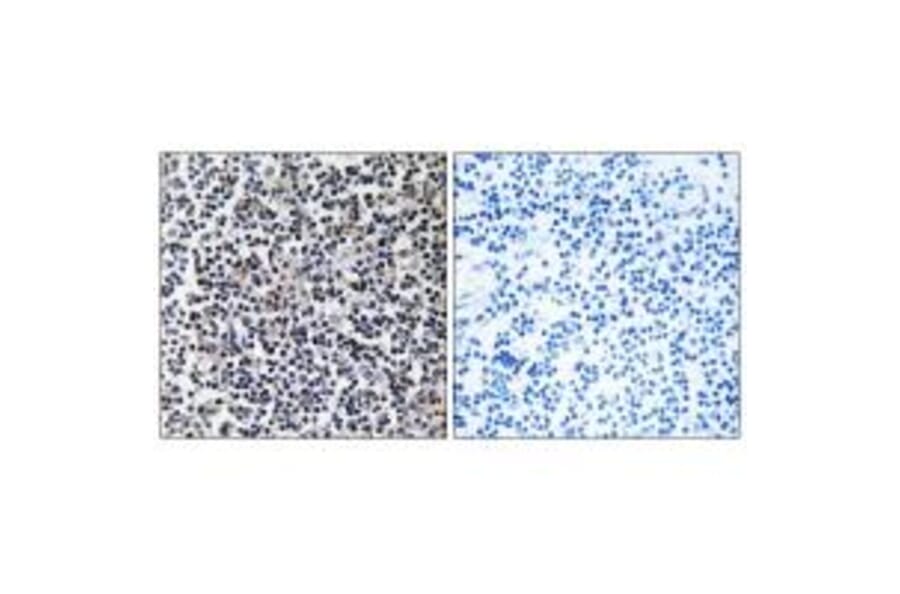 Immunohistochemistry - TACC3 Antibody from Signalway Antibody (35171) - Antibodies.com