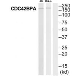 Western blot - MRCKa Antibody from Signalway Antibody (35291) - Antibodies.com