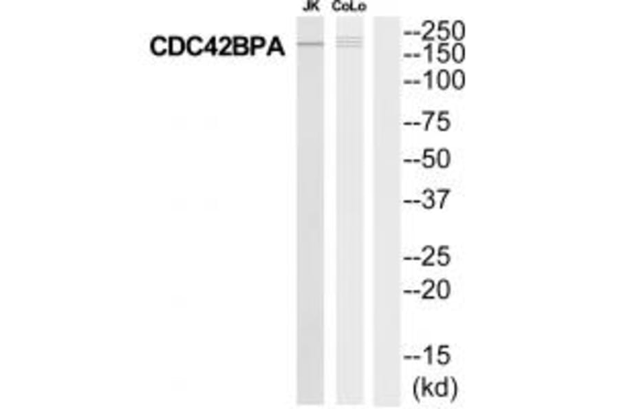Western blot - MRCKa Antibody from Signalway Antibody (35291) - Antibodies.com
