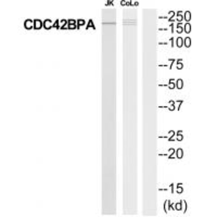 Western blot - MRCKa Antibody from Signalway Antibody (35291) - Antibodies.com