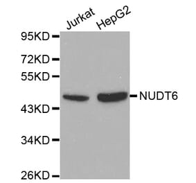 Western blot - NUDT6 antibody from Signalway Antibody (38116) - Antibodies.com
