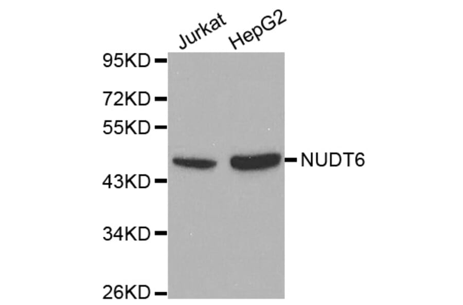 Western blot - NUDT6 antibody from Signalway Antibody (38116) - Antibodies.com