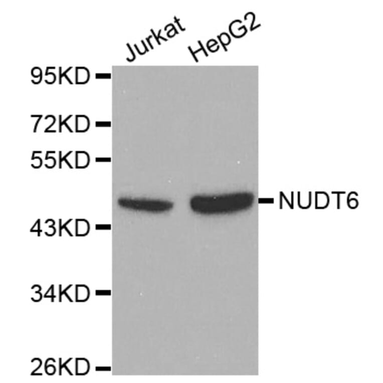 Western blot - NUDT6 antibody from Signalway Antibody (38116) - Antibodies.com