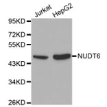 Western blot - NUDT6 antibody from Signalway Antibody (38116) - Antibodies.com