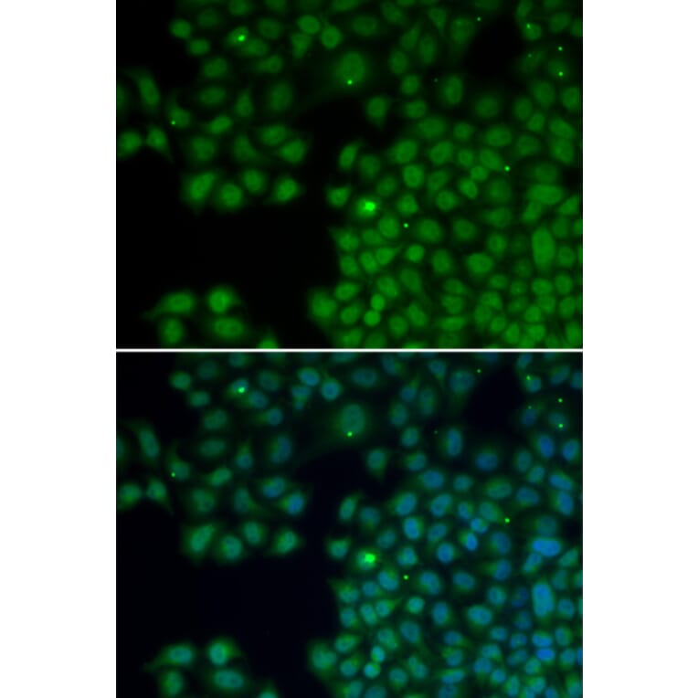 Immunofluorescence - NUDT6 antibody from Signalway Antibody (38116) - Antibodies.com