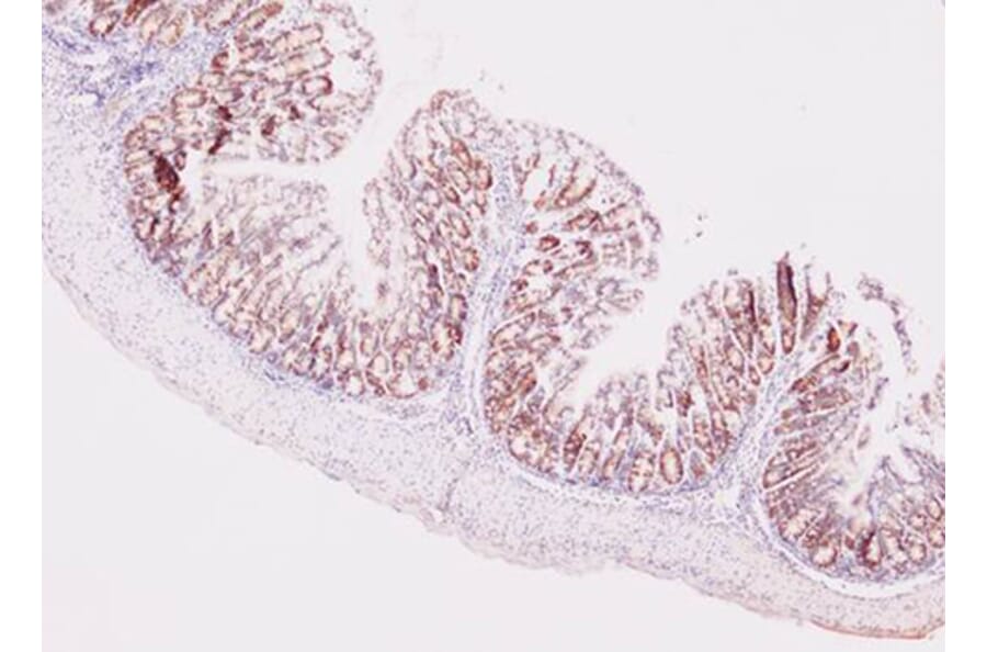 Immunohistochemistry - MKI67 antibody from Signalway Antibody (38358) - Antibodies.com