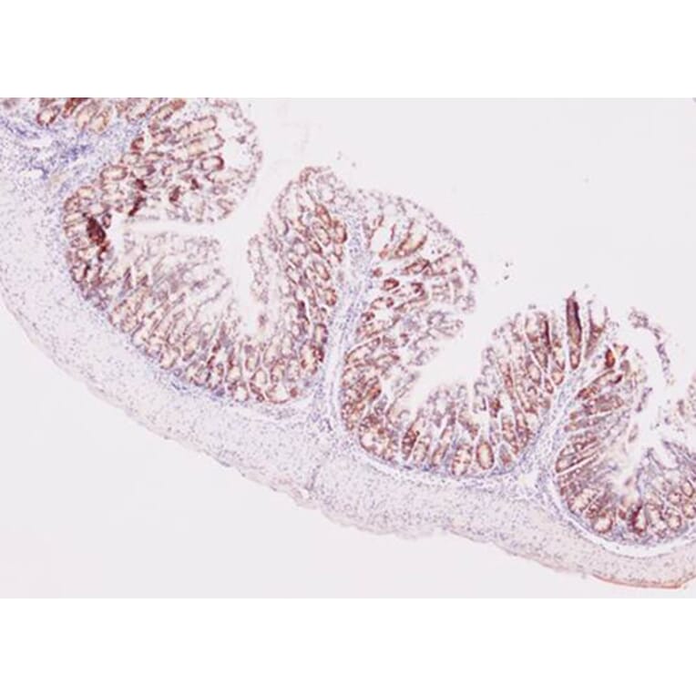 Immunohistochemistry - MKI67 antibody from Signalway Antibody (38358) - Antibodies.com