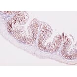 Immunohistochemistry - MKI67 antibody from Signalway Antibody (38358) - Antibodies.com