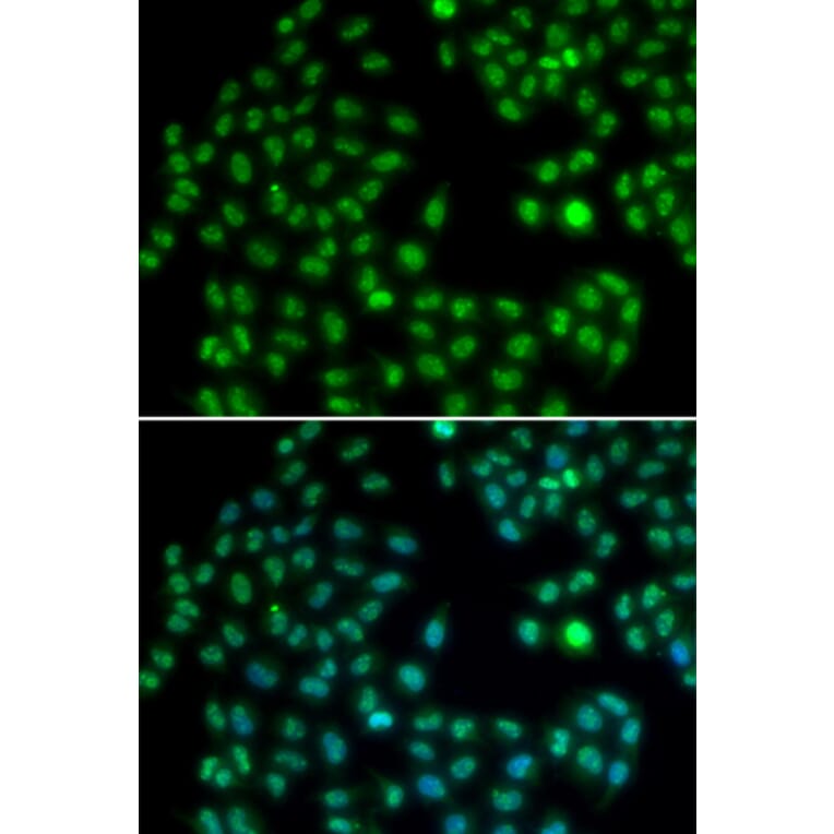 Immunofluorescence - MKI67 antibody from Signalway Antibody (38358) - Antibodies.com