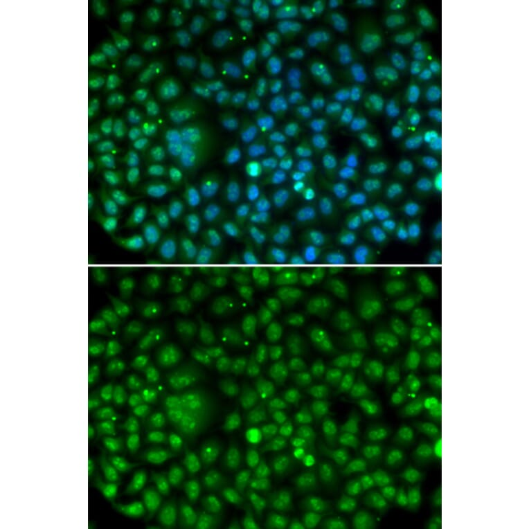 Immunofluorescence - MKI67 antibody from Signalway Antibody (38358) - Antibodies.com