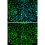 Immunofluorescence - MKI67 antibody from Signalway Antibody (38358) - Antibodies.com