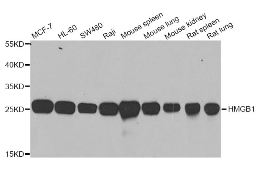 Western blot - HMGB1 antibody from Signalway Antibody (38424) - Antibodies.com