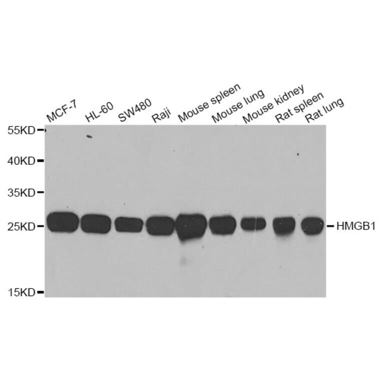 Western blot - HMGB1 antibody from Signalway Antibody (38424) - Antibodies.com