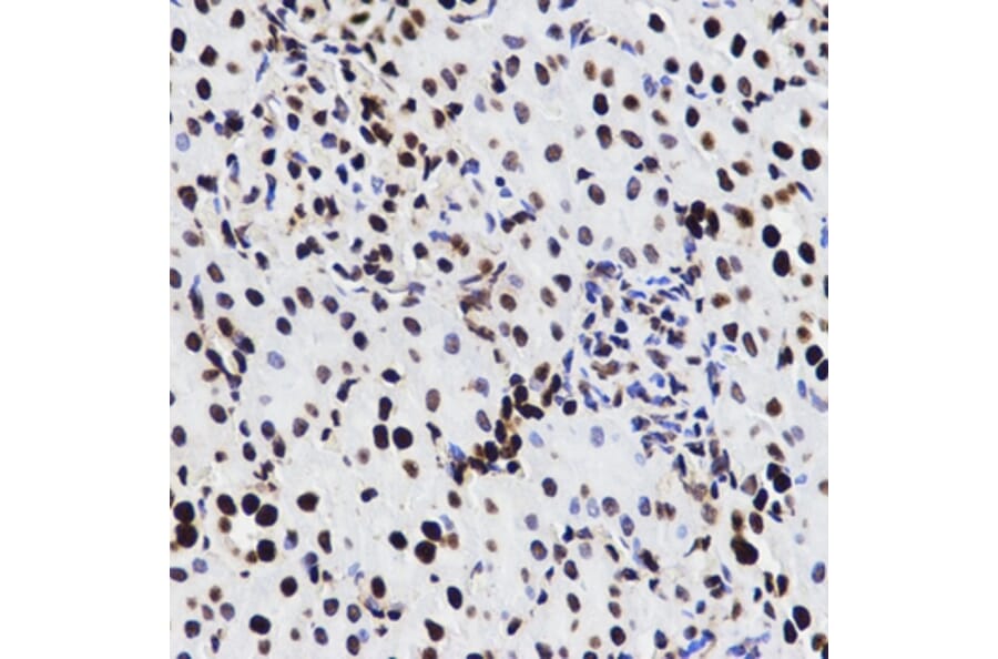 Immunohistochemistry - HMGB1 antibody from Signalway Antibody (38424) - Antibodies.com