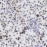 Immunohistochemistry - HMGB1 antibody from Signalway Antibody (38424) - Antibodies.com