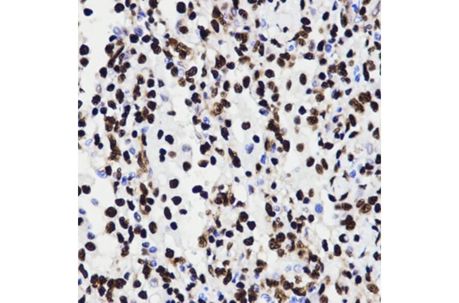Immunohistochemistry - HMGB1 antibody from Signalway Antibody (38424) - Antibodies.com