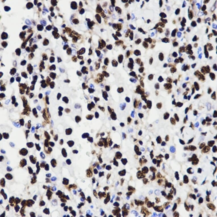 Immunohistochemistry - HMGB1 antibody from Signalway Antibody (38424) - Antibodies.com