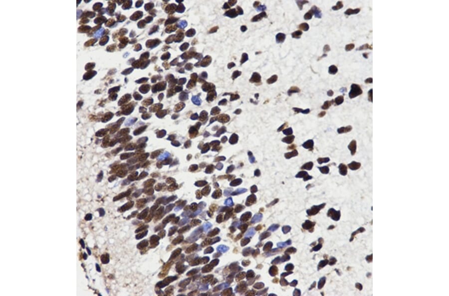 Immunohistochemistry - HMGB1 antibody from Signalway Antibody (38424) - Antibodies.com