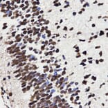 Immunohistochemistry - HMGB1 antibody from Signalway Antibody (38424) - Antibodies.com