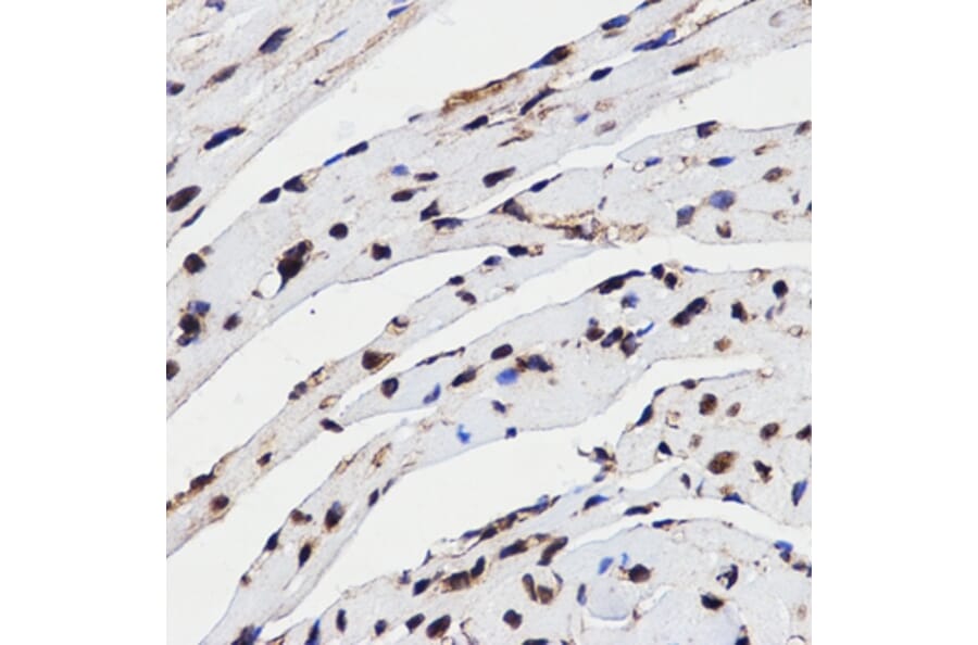 Immunohistochemistry - HMGB1 antibody from Signalway Antibody (38424) - Antibodies.com