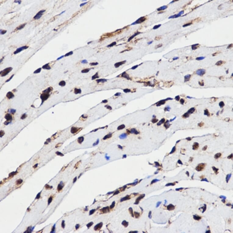 Immunohistochemistry - HMGB1 antibody from Signalway Antibody (38424) - Antibodies.com