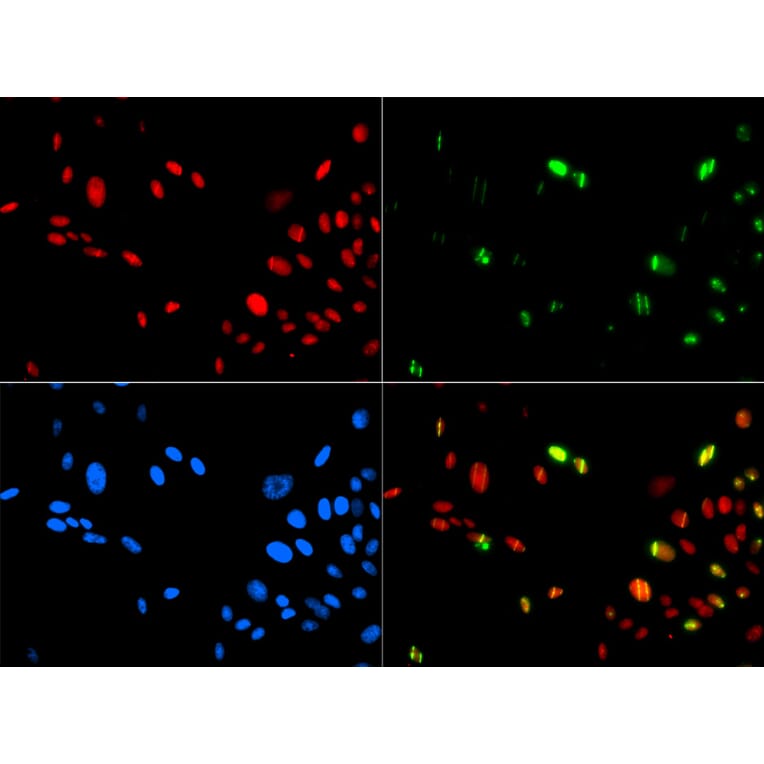 Immunofluorescence - HMGB1 antibody from Signalway Antibody (38424) - Antibodies.com