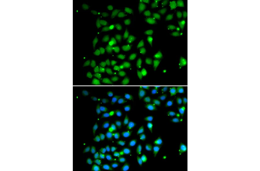 Immunofluorescence - HMGB1 antibody from Signalway Antibody (38424) - Antibodies.com