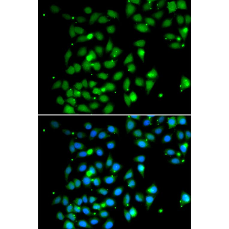 Immunofluorescence - HMGB1 antibody from Signalway Antibody (38424) - Antibodies.com