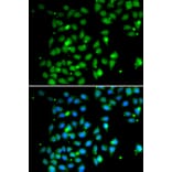 Immunofluorescence - HMGB1 antibody from Signalway Antibody (38424) - Antibodies.com