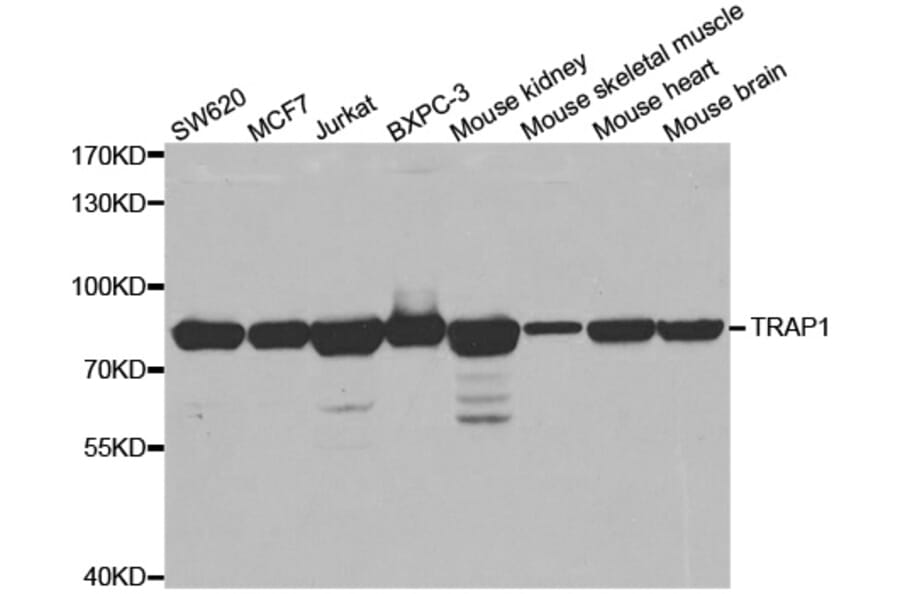 Western blot - TRAP1 antibody from Signalway Antibody (38457) - Antibodies.com