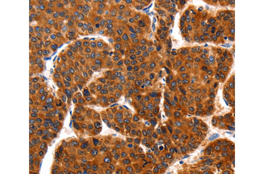 Immunohistochemistry - TRAP1 antibody from Signalway Antibody (38457) - Antibodies.com