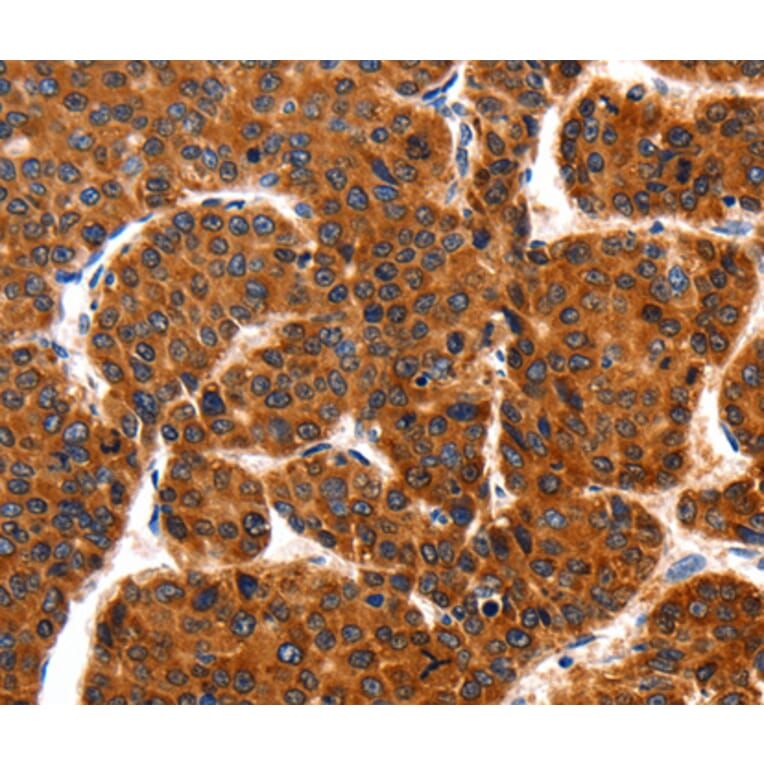 Immunohistochemistry - TRAP1 antibody from Signalway Antibody (38457) - Antibodies.com
