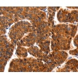Immunohistochemistry - TRAP1 antibody from Signalway Antibody (38457) - Antibodies.com